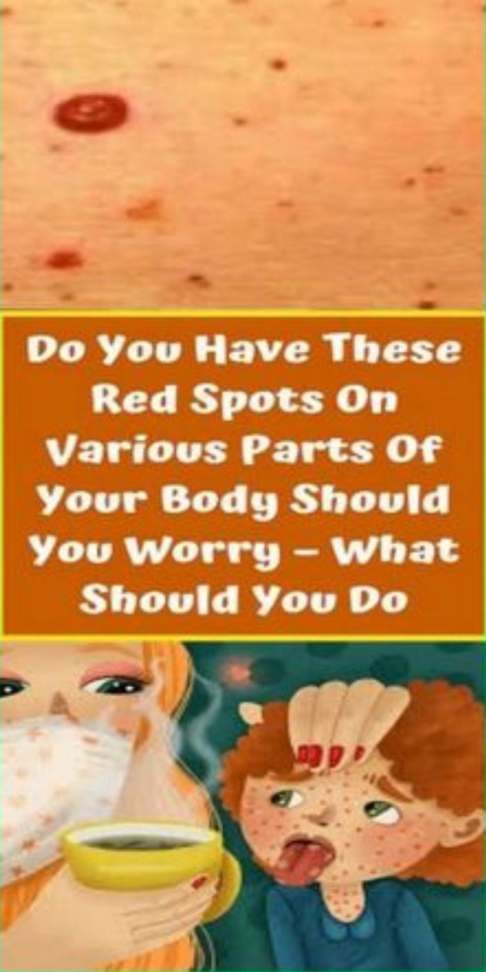 what-do-these-red-dots-on-your-skin-mean-natural-health-care