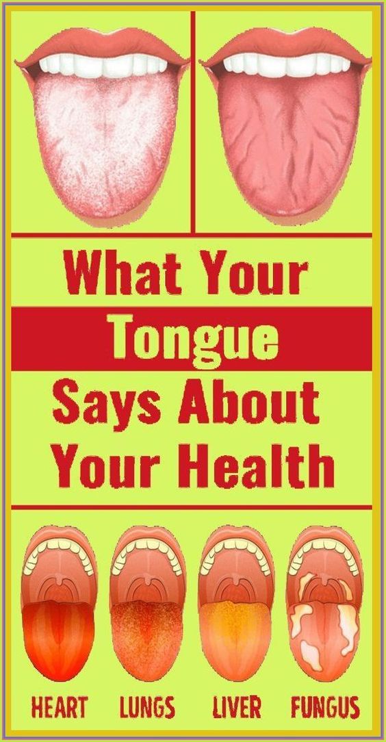 What Your Tongue is Trying to Tell You About Your Health – Natural ...